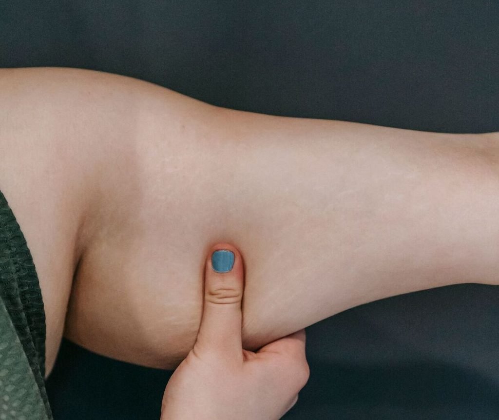 Different skin weight loss outcomes after body changes 1